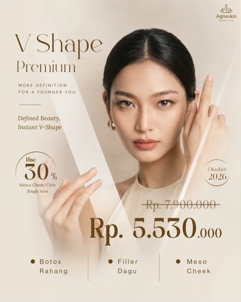 Promo Banjarbaru: diskon 30% V Shape Premium