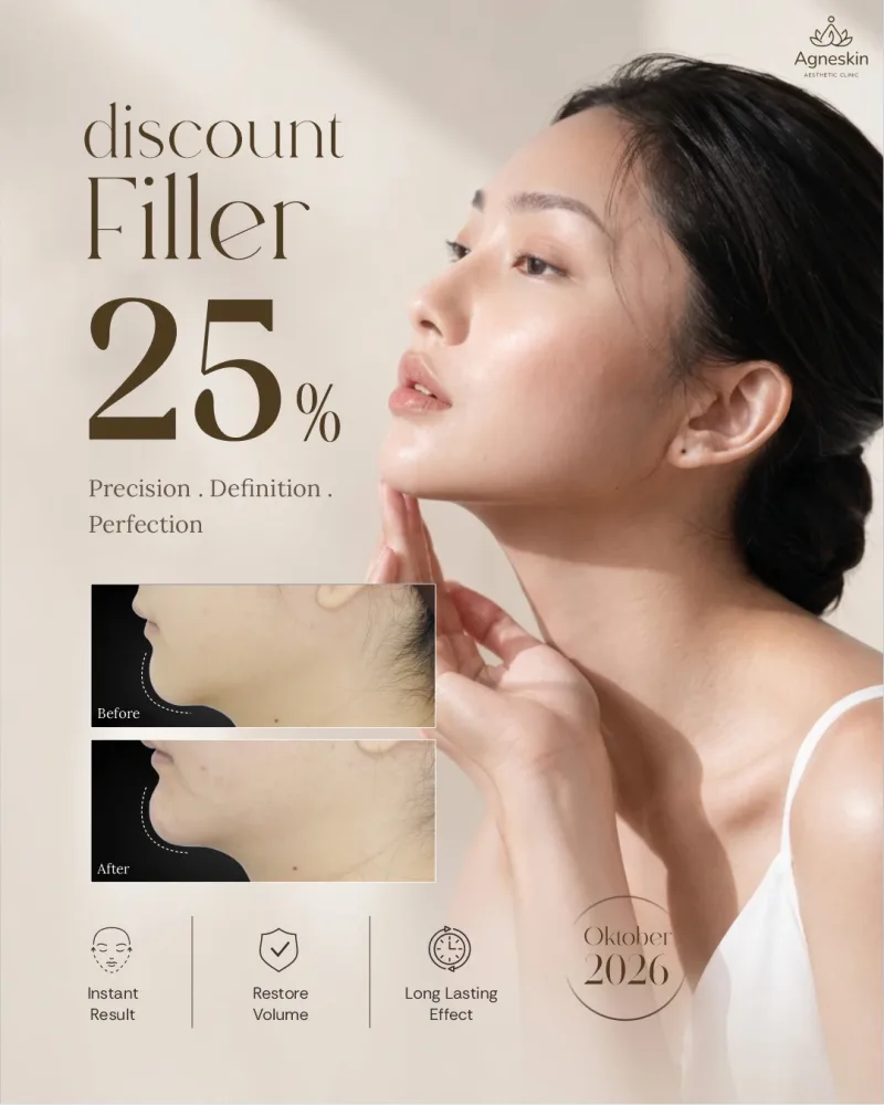 Promo Banjarbaru: diskon 25% Filler
