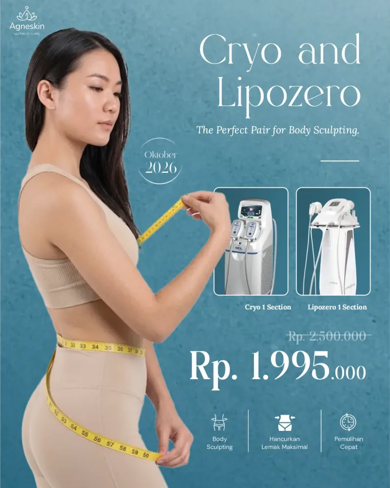 Promo Banjarmasin: Cryo dan Lipozero