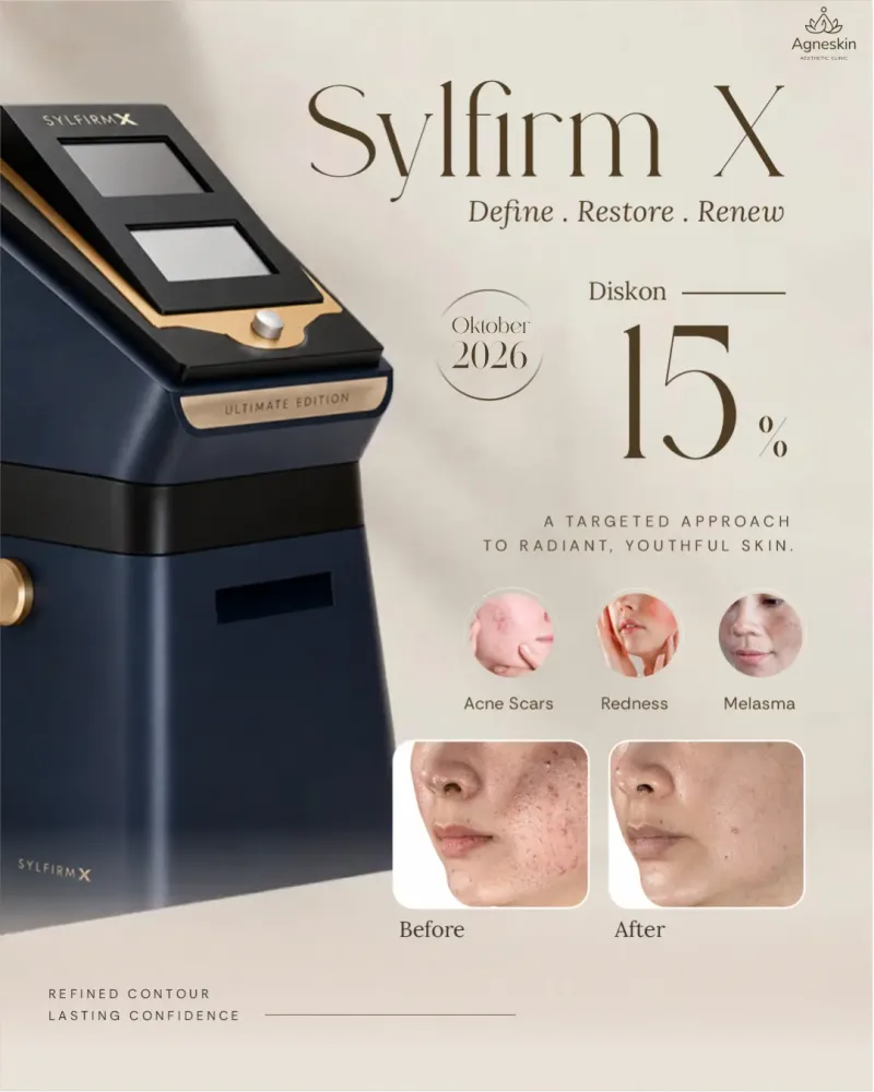 Promo Banjarmasin: diskon 15% Sylfirm X